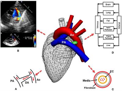 Multiscale Modeling Is Required for the Patent Ductus Arteriosus in Preterm Infants